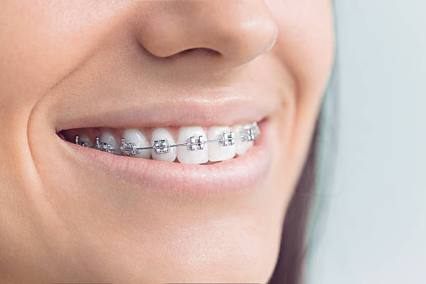 Best Dental Inlays and Onlays  in Heath, TX